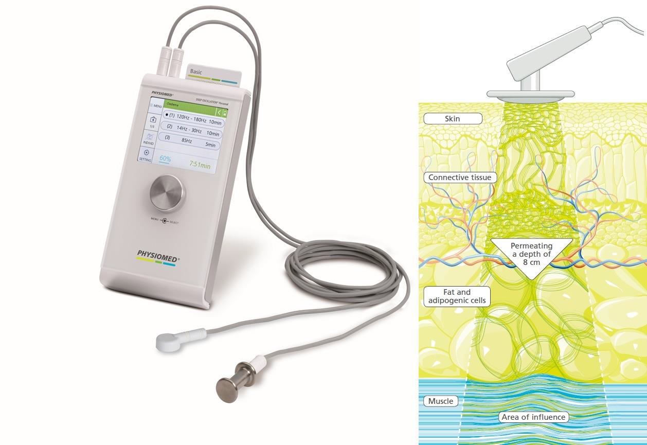 Terapia cu DEEP OSCILATION ® PERSONAL PRO